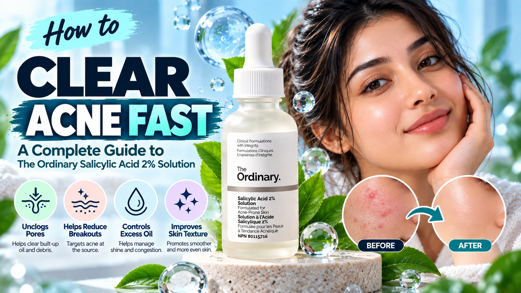 How to Clear Acne Fast: A Complete Guide to The Ordinary Salicylic Acid 2% Solution